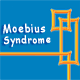 Jeu flash Moebius Syndrome
