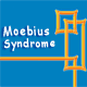 Moebius Syndrome